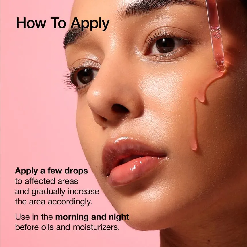 سرم ضدلک نیاسینامید / ترانگزامیک اسید آنوا
