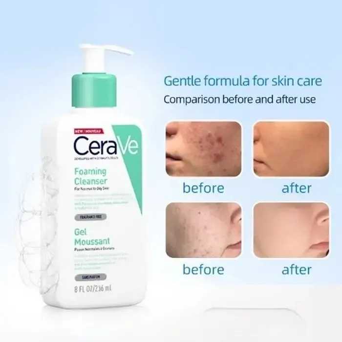 فوم شتسشوی صورت مخصوص پوست نرمال تا چرب سراوی