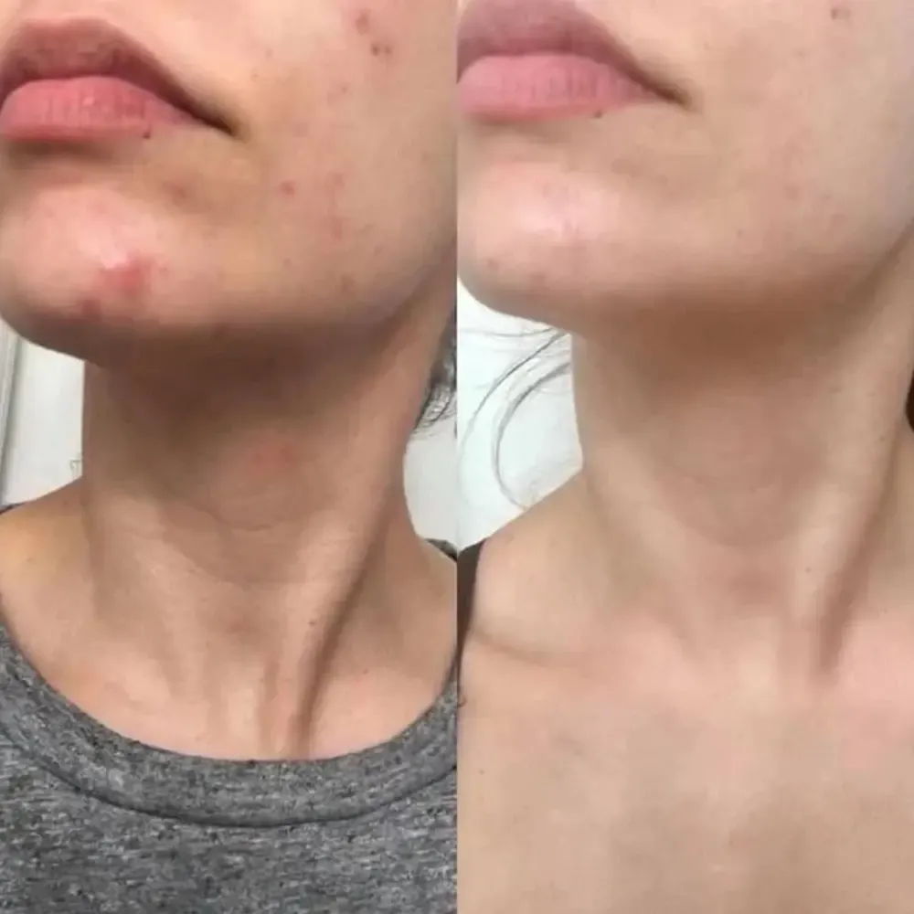 اسنس بایو لیفتینگ نامبر 9 نامبوزین Numbuzin bio lifting essence